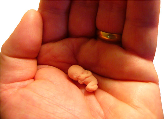 Video de niños que piden no matar a los bebés por medio del aborto